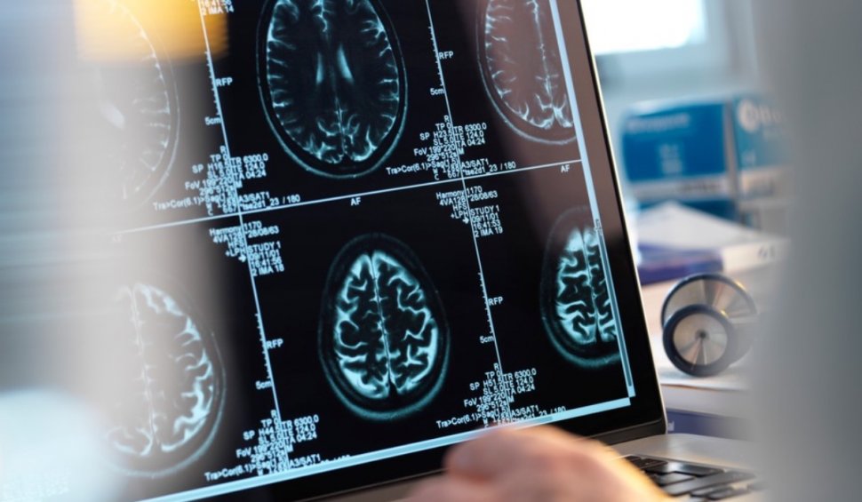 Primele implanturi Neuralink în creierul uman vor fi realizate în șase luni, anunță Elon Musk: „Credem că putem restabili vederea” Primele implanturi Neuralink în creierul uman vor fi realizate în șase luni, anunță Elon Musk: „Credem că putem restabili vederea”